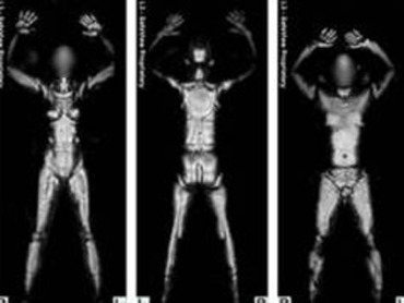 Body scan