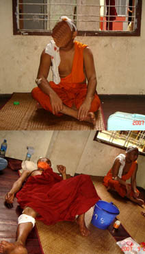 Photos of injured Burmese monks taken by a citizen journalist